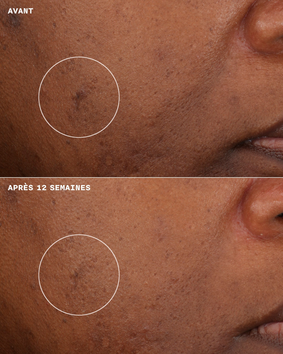 Even Better Clinical Crème Hydratante Illuminatrice