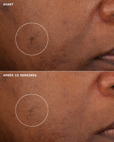 Even Better Clinical Crème Hydratante Illuminatrice